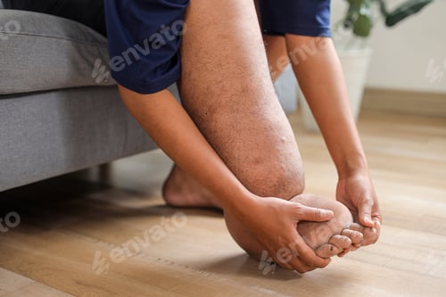 Preview: Person Touching Their Foot Which Is Severely Swollen Due To Lymphatic Filariasis