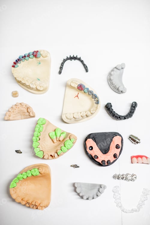 Preview: Artificial jaw models with dental implants
