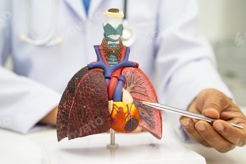 Preview: Pneumonia, lung cancer, Asian doctor holding human anatomy