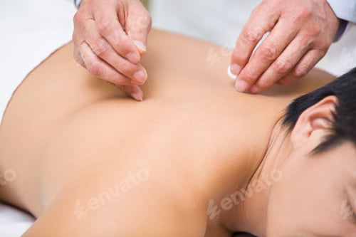 Preview: Patient receiving acupuncture
