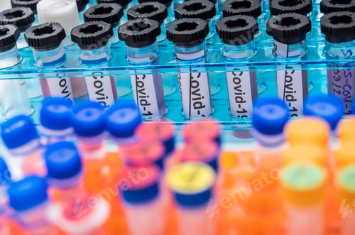 Preview: Vials with samples of SARS-COV-2 Covid-19 in a research laboratory, conceptual image
