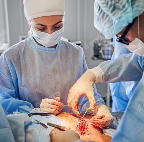 Preview: Surgical Team Performing Invasive Procedure in Operating Room