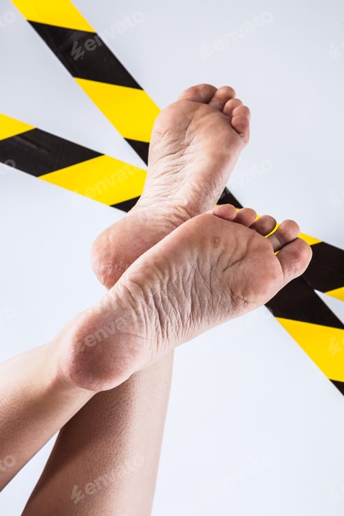 Preview: dehydrated skin female heels