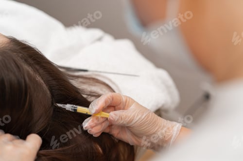 Preview: A beautician makes injections into the scalp for hair growth Mesotherapy for hair growth