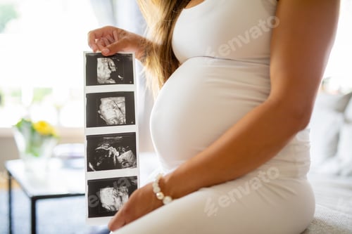 Preview: Close-up of pregnant woman holds ultrasound photos at her stomach