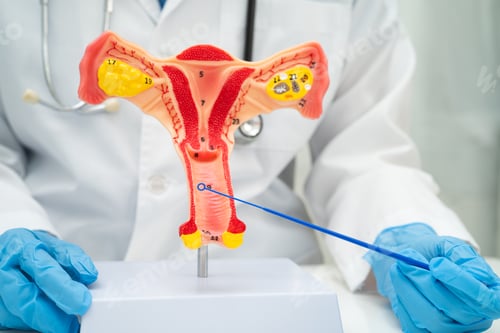 Preview: Doctor holding human uterus model for vaginal and cervix pap smear