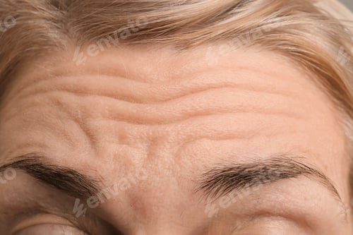 Preview: Female forehead with wrinkles