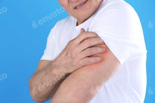 Visualização: Senior man scratching arm on color background, closeup. Allergy symptom