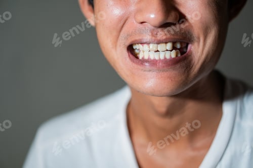 Preview: Person smiling and showing teeth close-up