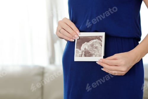 Preview: Proud future mother