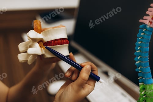 Preview: Doctor shows intervertebral hernia to a patient in his office.