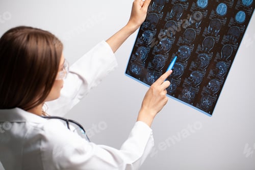 Preview: Doctor examines an MRI image of the patient