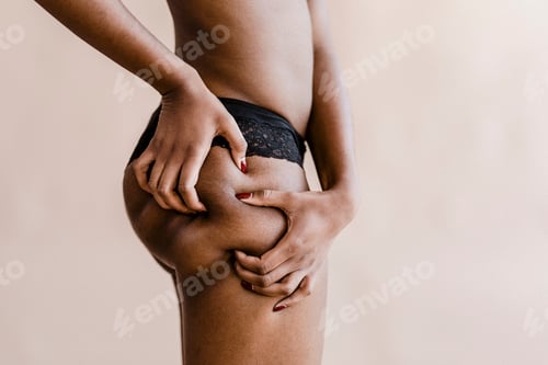 Preview: Black woman with cellulites