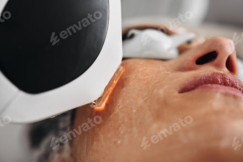 Preview: A woman receives IPL therapy in a beauty salon.