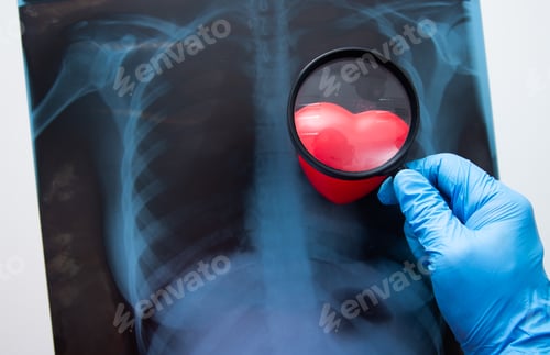 Preview: Hand holding Magnifying glass on X ray of a human chest.