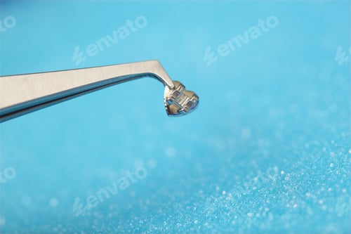 Preview: Pincers with one bracket, teeth care