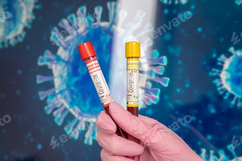 Preview: Covid-19 test samples in the hands of a doctor