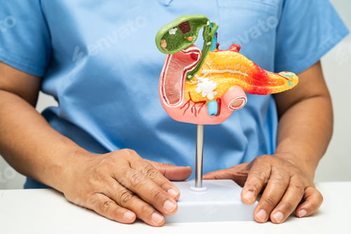 Preview: Pancreatitis, pancreatic cancer, Asian doctor with pancreas, gallbladder