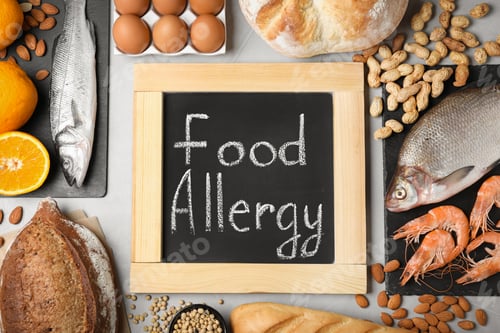 Preview: Chalkboard with words FOOD ALLERGY and groceries on grey table, flat lay
