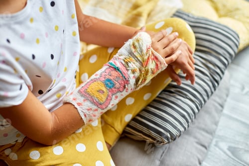 Preview: Teen girl with a broken arm at home an orthopedic cast