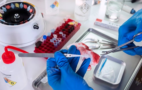 Preview: Police scientist examines bloodstained gauze from a drug overdose case, conceptual image