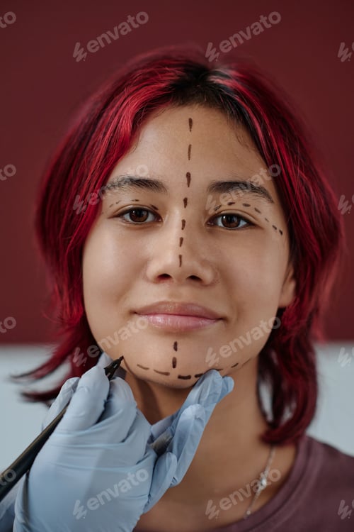 Preview: Cute girl looking at camera while plastic surgeon drawing liftmarks on her face