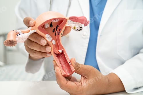 Preview: Uterus, doctor with anatomy model for study diagnosis and treatment in hospital.