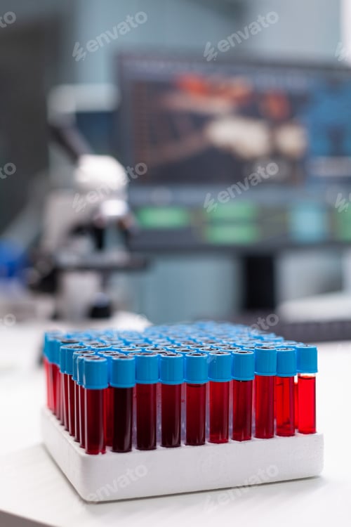 Preview: Vacutainer tubes for collecting blood samples during biological chemistry examination