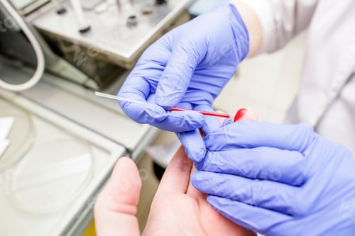 Preview: The doctor takes the patient's blood test from a finger