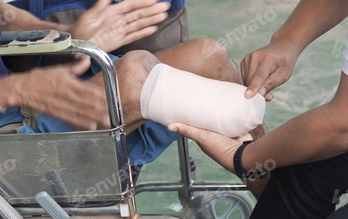Preview: Elastic bandaged below knee amputation