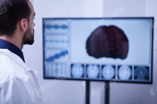 Preview: Handsome doctor analyzing a braing after a car accident