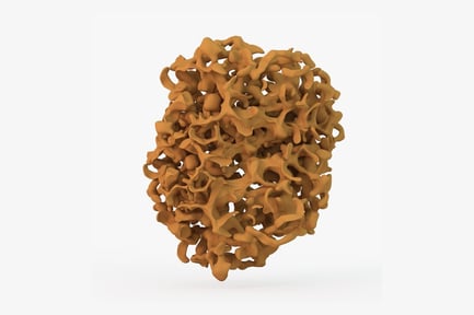 Preview: Porous Bone Structure: Osteoporosis