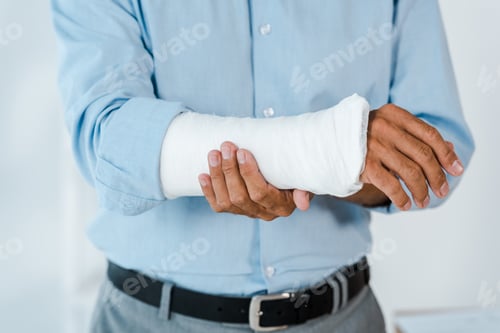 Preview: cropped view of injured man touching broken arm wrapped in gypsum bandage
