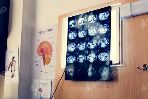 Preview: Doctor checking x-ray results