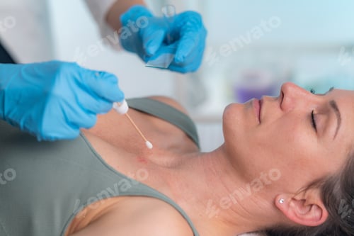 Preview: Dermatologist taking sample from patients skin and examining potential fungal infections
