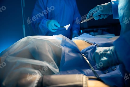 Preview: Surgery Operation Underway in Hospital Operating Room