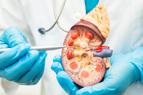 Preview: Kidney disease, Chronic kidney disease ckd, Doctor hold human model to treat and study in hospital.