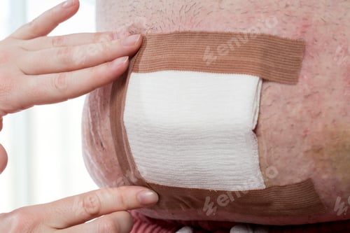 Preview: Nurse dressing the patient's wound