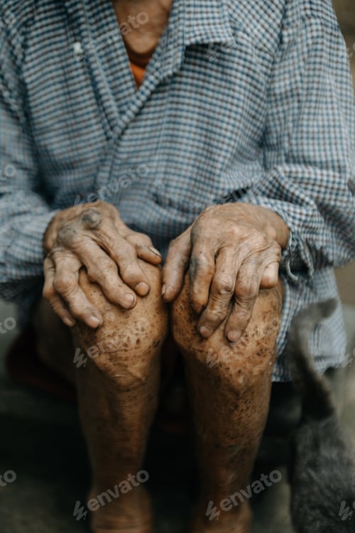 Preview: Close up of male wrinkled hands, old man is wearing skin disease and anxiety Copy space.