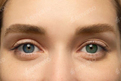 Preview: Woman with beautiful eyes of different colors, closeup. Heterochromia iridis