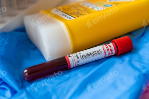 Preview: Closeup shot of a blood test tube with red lid for coronavirus next to a yellow plastic bottle