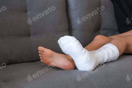 Preview: woman with Plastered Leg in a cast is recovering at home.