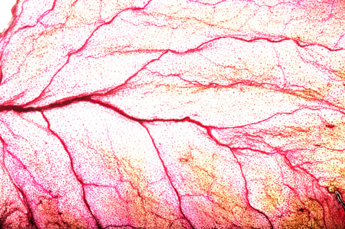 Preview: Dry Leaf Texture Abstract Background