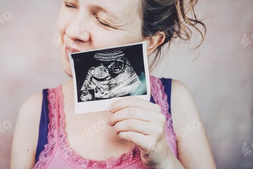 Preview: Woman holding the ultrasound of her baby
