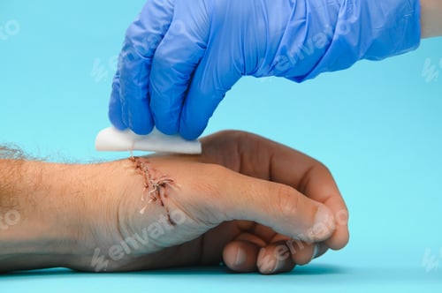 Preview: nurse cleaning wound with cotton ball and dressing set, wound care process