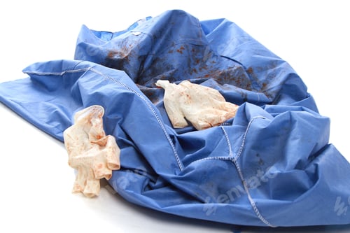 Preview: High angle shot of a surgeon's gown and gloves after surgery