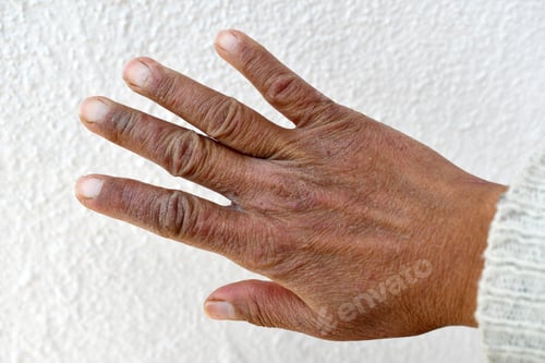 Preview: Elderly woman dry hand skin.