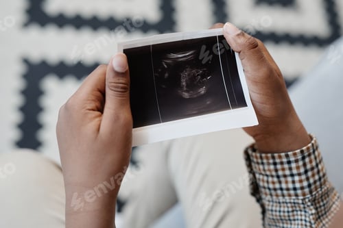 Preview: Boy Holding X Ray of Baby