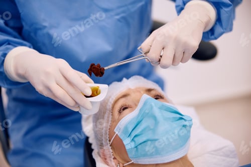 Preview: Close up of eye surgeon using surgical forceps with iodine gauze in operating room at the clinic.