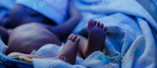 Preview: newborn baby lying under blue lamp because of bilirubin, phototherapy, he has jaundice
